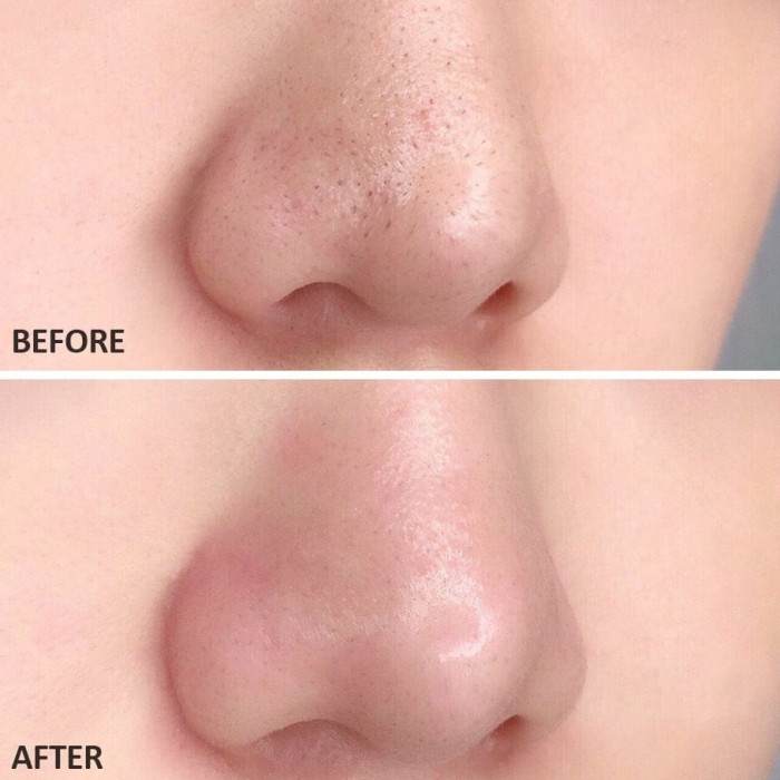 Глиняна маска-стік для обличчя Madagascar Centella Poremizing Quick Clay Stick Mask від SKIN1004 - Зображення 2